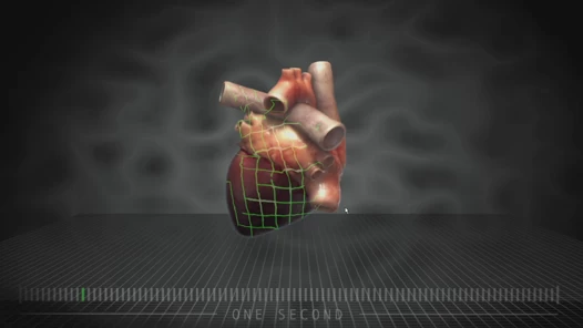 コンピューターモデリングにより医師は心臓発作を事前に予測できる