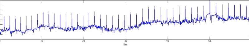 心電図測定結果