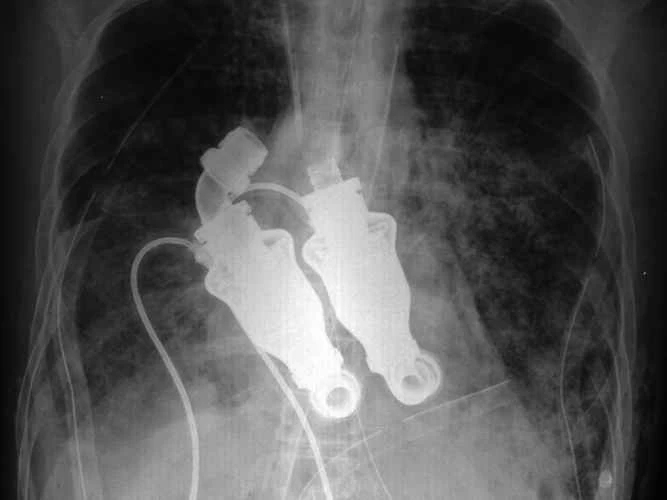 心臓：鼓動は不要