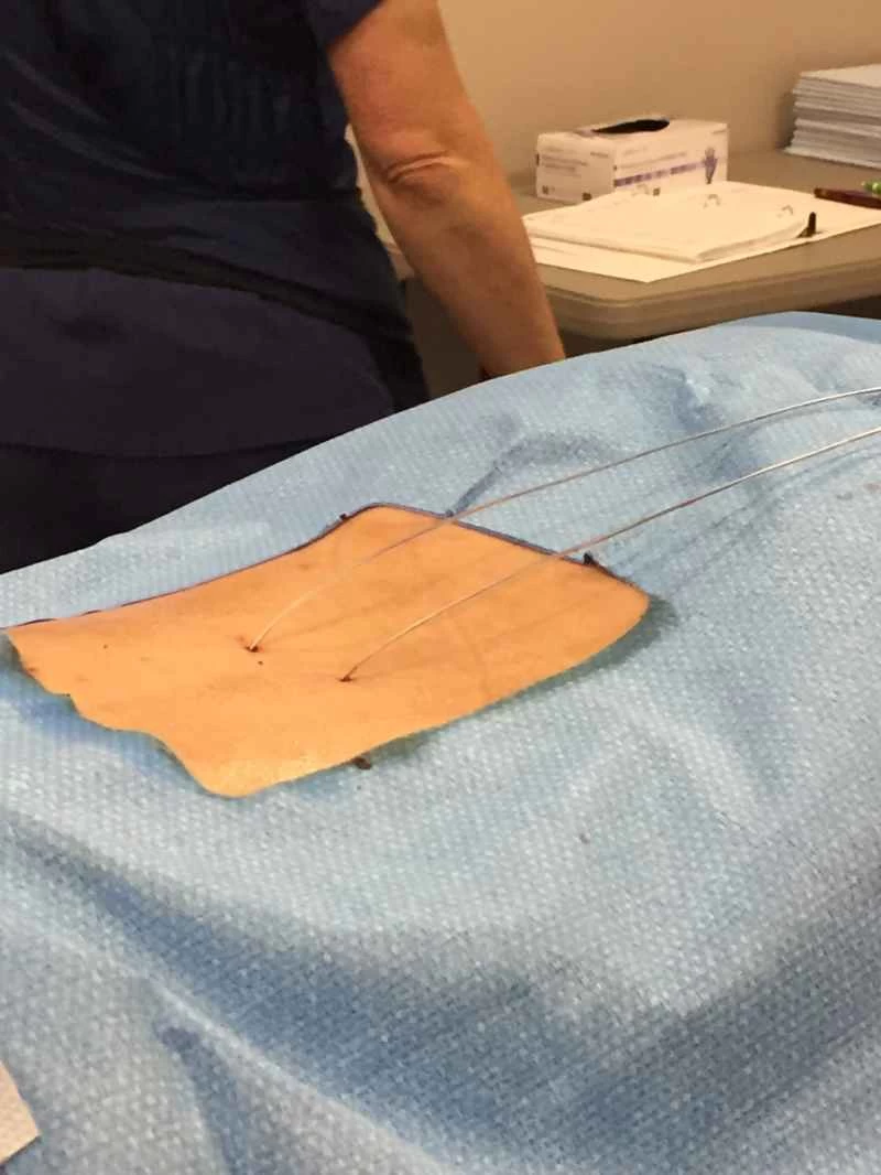 脊椎のテストリード