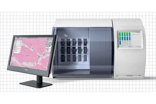 インテリサイト病理学